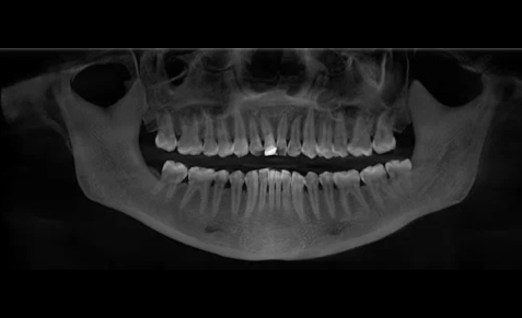 cbct-scan-pukekohe-1-1